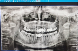 口腔科CBCT